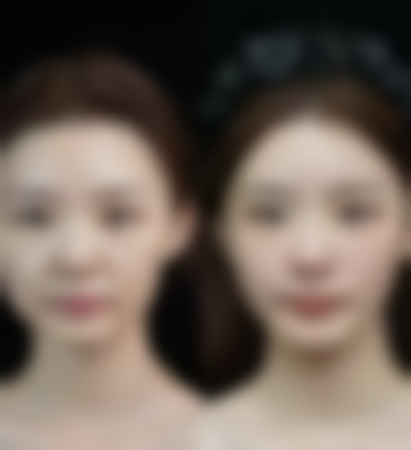 理性选择，美丽无忧