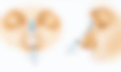 王立仁医生简介项目优势