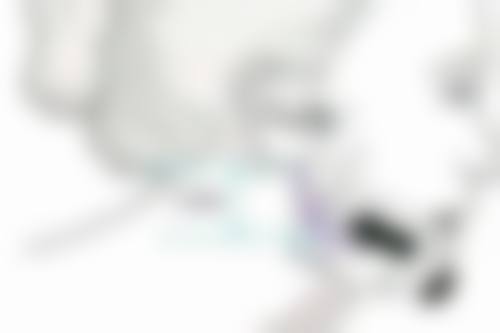 手术伤口疤痕增生用什么方法治疗:冷冻治疗,低温消除增生