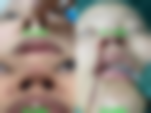 南京秦淮安臻美整形医院口碑好不好？附真实患者口碑评价