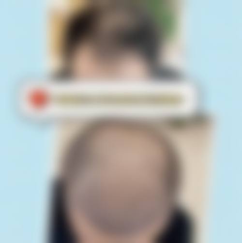 广汉美丽部落医疗美容诊所怎么样,更擅长什么手术