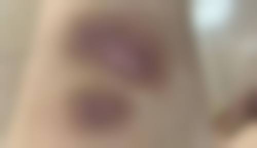 株洲爱思特医疗美容医院价格表