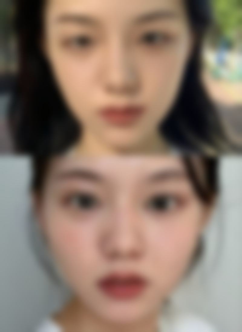 天生双眼皮与人工双眼皮，谁更胜一筹？