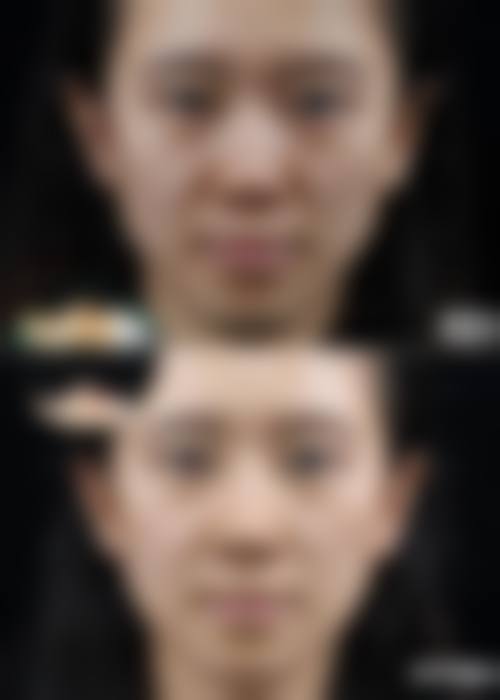 张家港盛美丽人医疗美容诊所更擅长什么