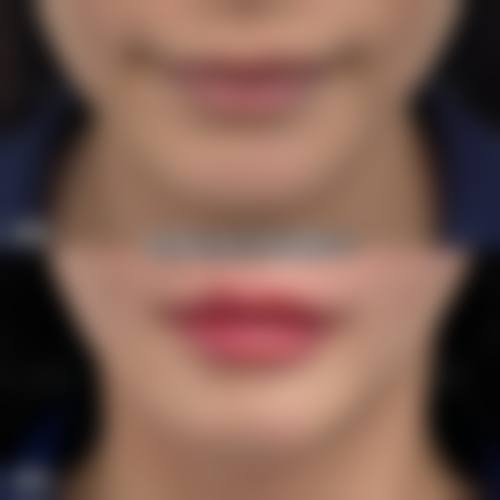 宁波海曙美苑医学美容专科门诊部怎么样