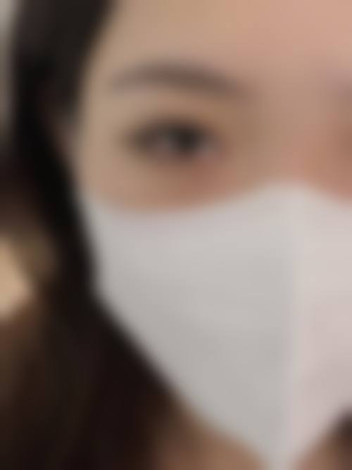 宁波海曙美苑医学美容专科门诊部顾客实例