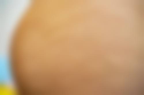 朱刚强医生顾客实例图片