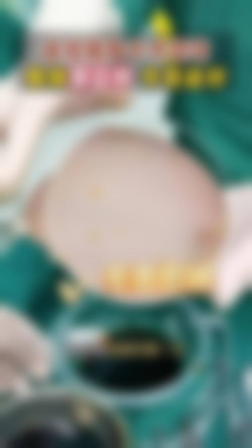 衡阳华美魅力医疗美容门诊部顾客实例