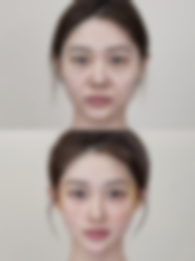 3岁小孩脸上手术疤痕慢慢能修复吗：专精治疗助力修复