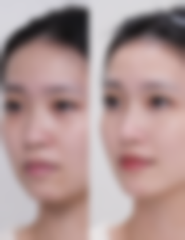 张家港盛美丽人医疗美容诊所评价