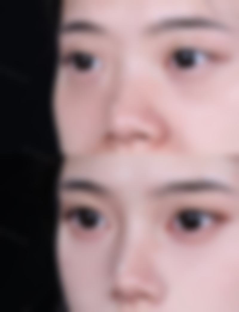 3岁小孩脸上外伤疤痕慢慢能修复吗：护理与深度共同影响