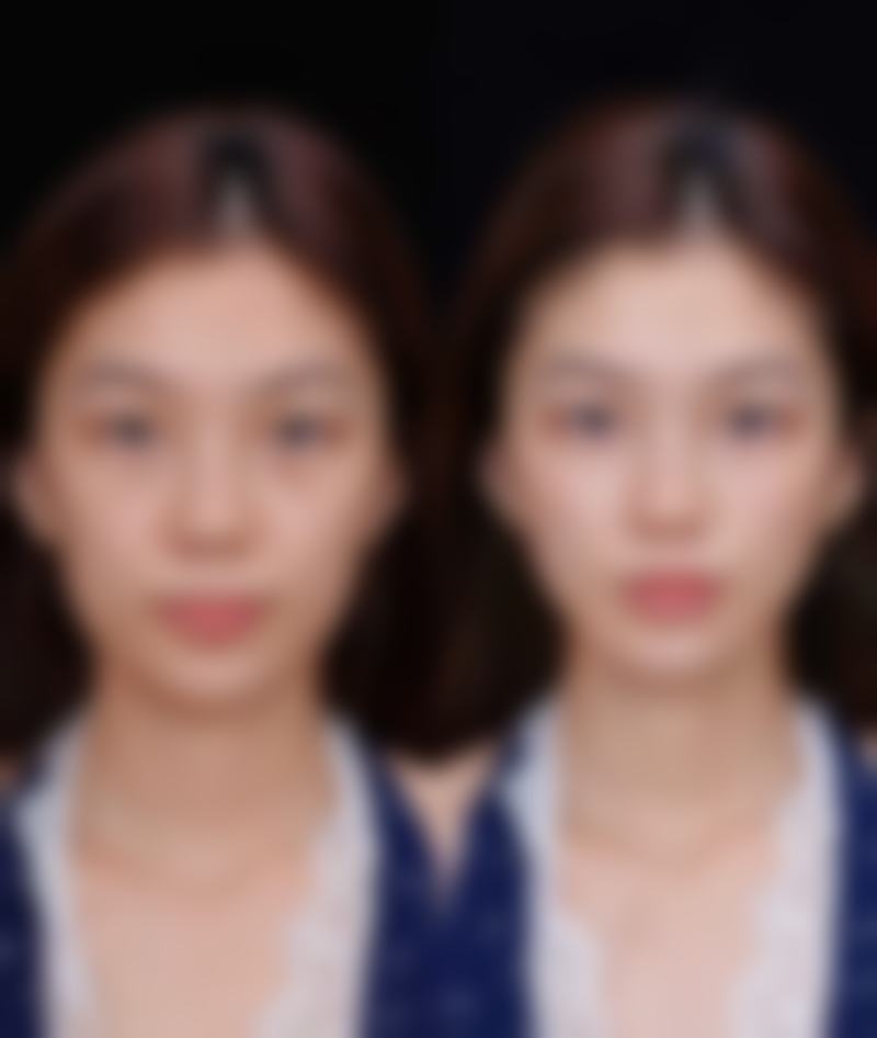 会理熹亚汐妍整形医院价格表