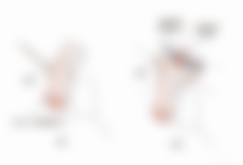 什么症状属于疤痕皮肤