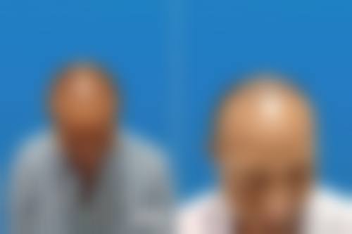 无锡万佳医疗美容诊所怎么样，更擅长什么手术