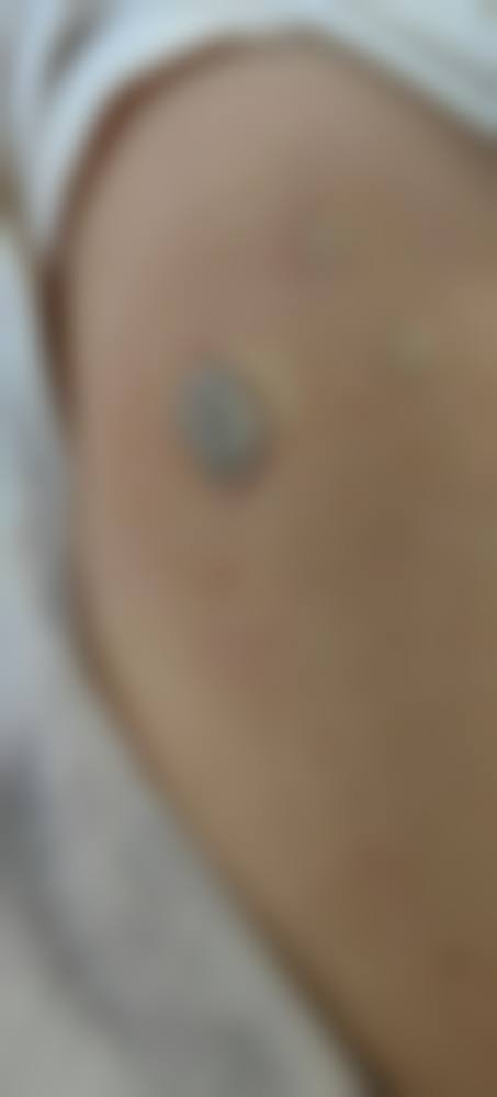 天津津南惟拉亚太医疗整形美容口碑情况