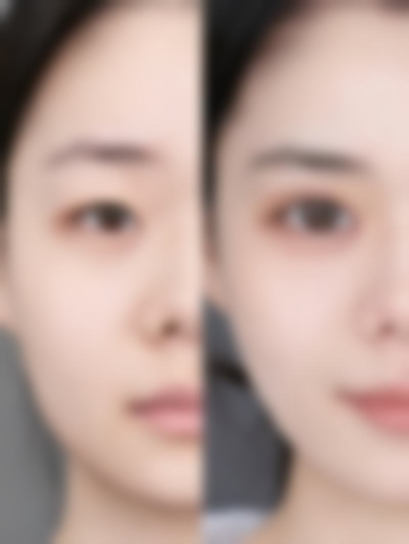 杨本明医生简介做手术价格