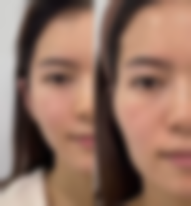 烫伤如何快速消除疤痕之避开不靠谱偏方