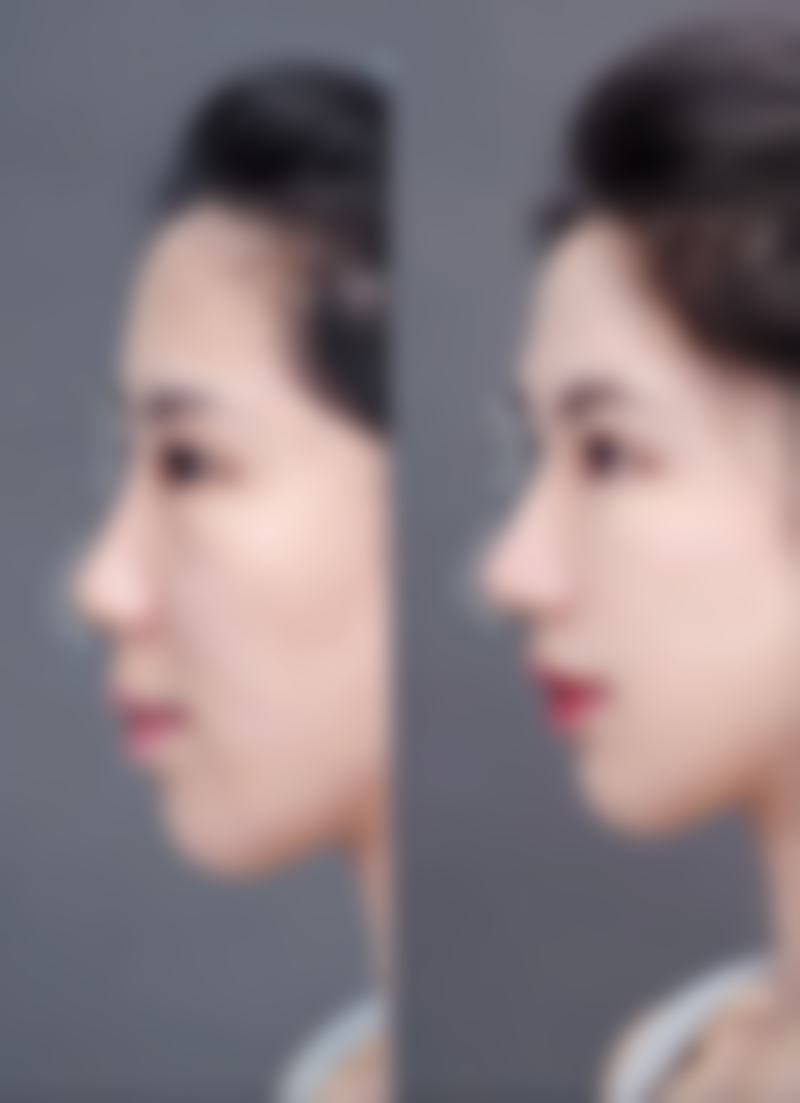 七、苏州爱思特医疗整形美容医院口碑好不好?附真实患者口碑评价