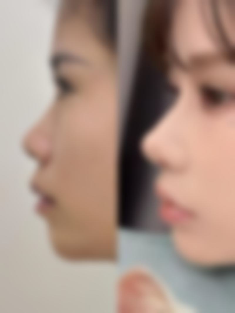 岳阳市纽尚阳光医疗美容医院怎么样价格表