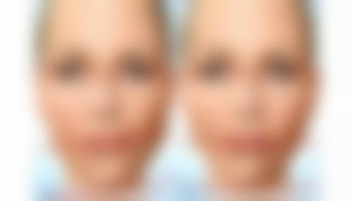 黑眼圈和眼袋怎去除之自然疗法的奇妙功效