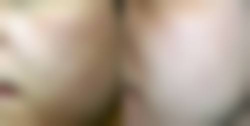 隆鼻硅胶膨体哪个好之价格大比拼