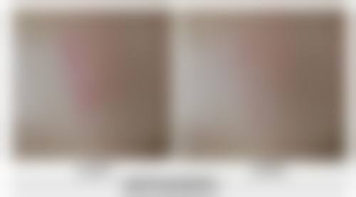 假体隆胸260在不同体型上的视觉成效——千人千面