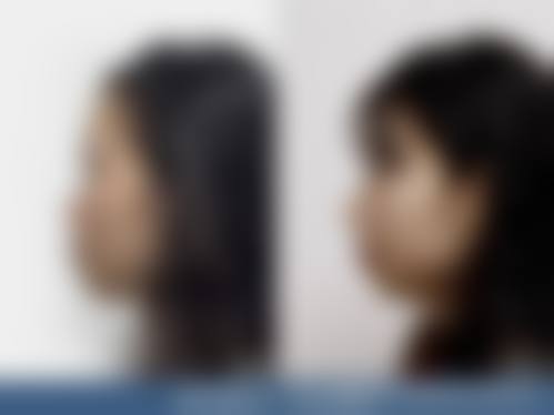 菏泽思诺尔医疗美容诊所怎么样，价格表