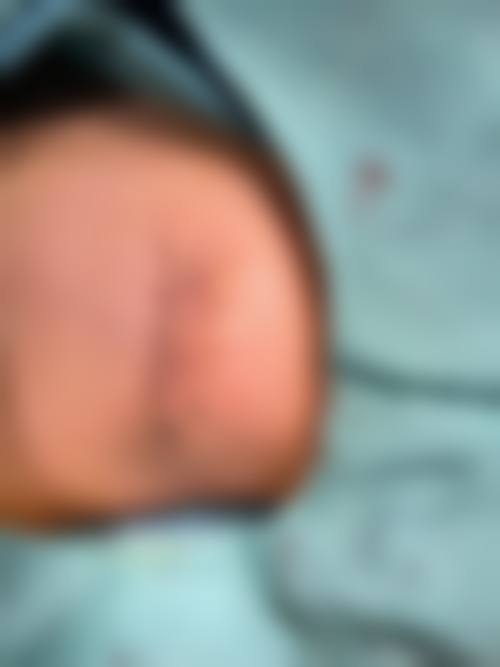 菏泽思诺尔医疗美容诊所怎么样，可靠吗