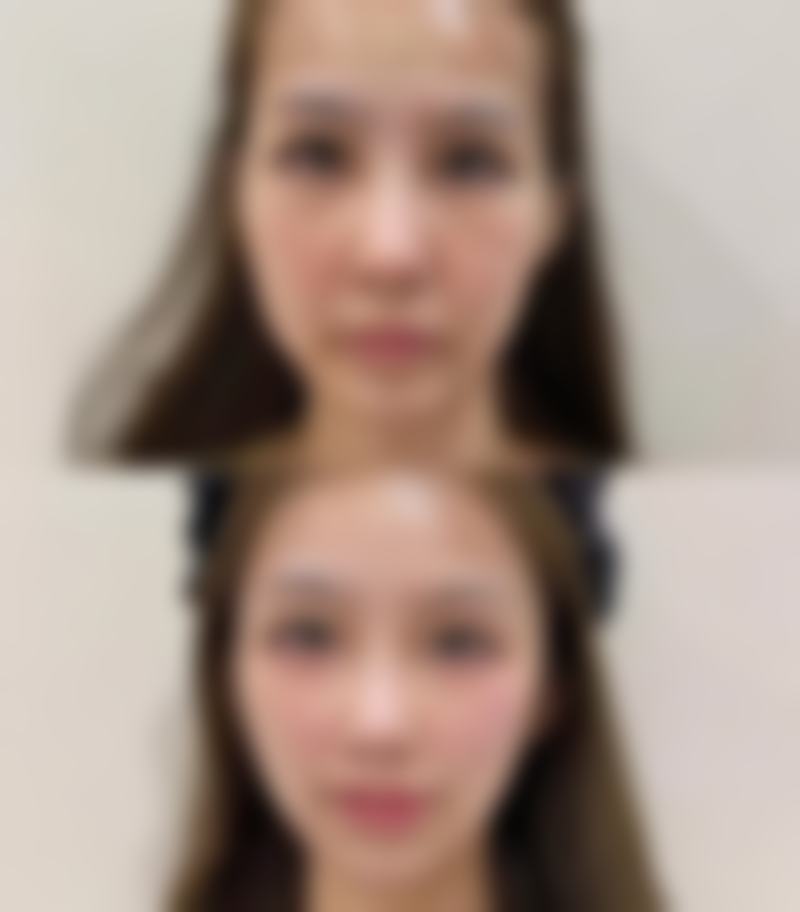 重庆周业松整形医院价格表