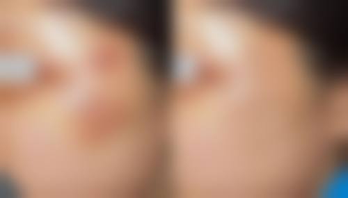 刘学源医生怎么挂号