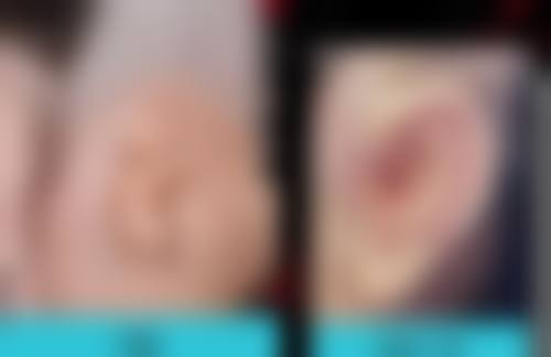 杨小刚医生简介做手术价格