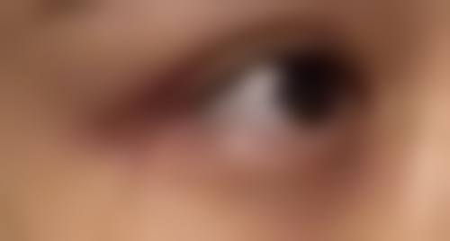 做了阴道紧缩术多久能同床？恢复期2个月+护理指南必看