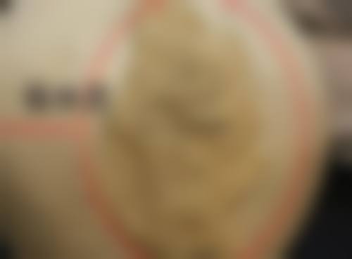 不同类型医院瘦脸针多久可以出成效：成效对比分析