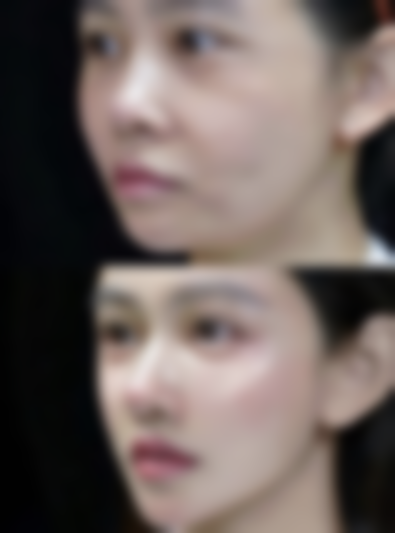 刘学源医生项目优势