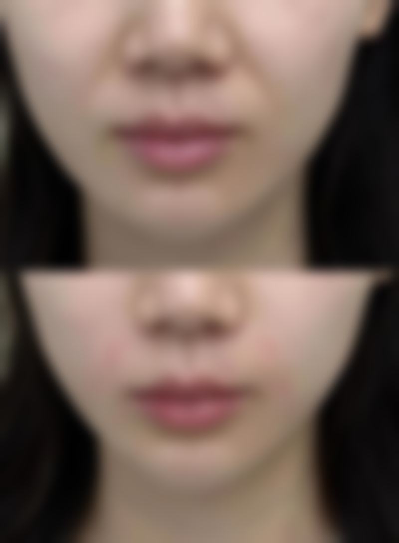 刘学源医生做手术价格