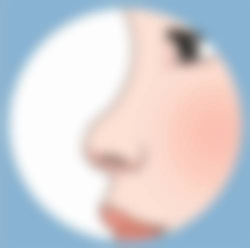 双眼皮手术拆线多久可以碰水之作死行为预警