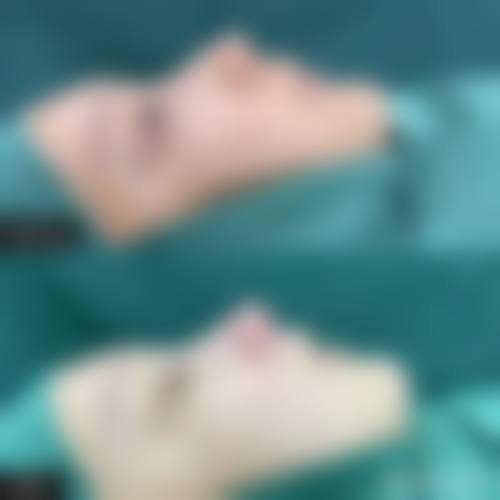 三、济南历下区人民医院整形外科怎么样,口碑评价如何?