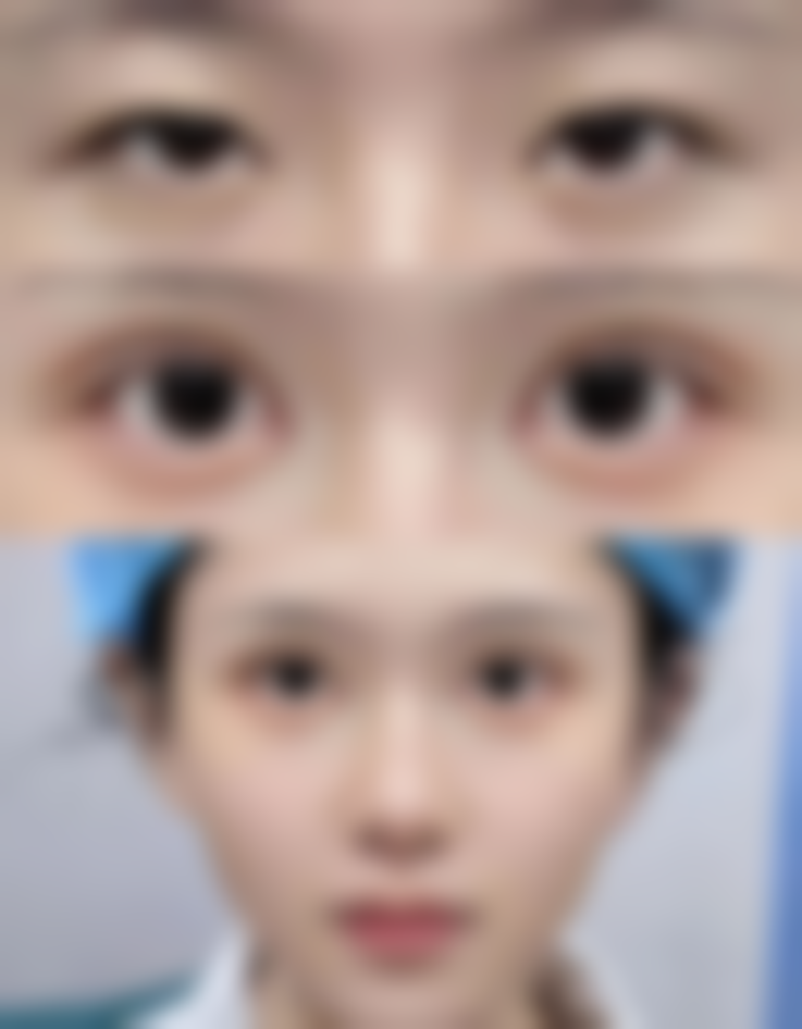 江门玛丽整形医院怎么样——口碑评价