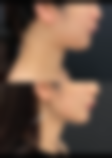 閔丈桓医生做手术价格