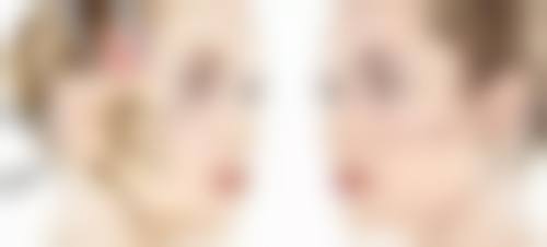 面部青春痘疤痕怎么治疗——日常护理治疗：预防胜于治疗的“关键法则”