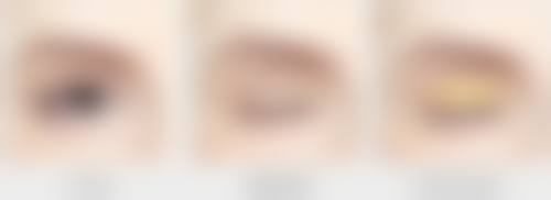 面部青春痘疤痕怎么治疗——中医疗疗方式：千年智慧的“温和调理”