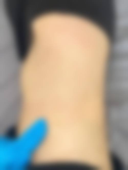 深圳美立达医疗美容门诊部怎么样，价格表情况