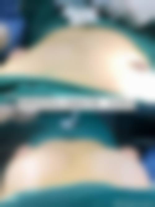 济南旭美医疗整形美容医院怎么样,口碑评价如何?