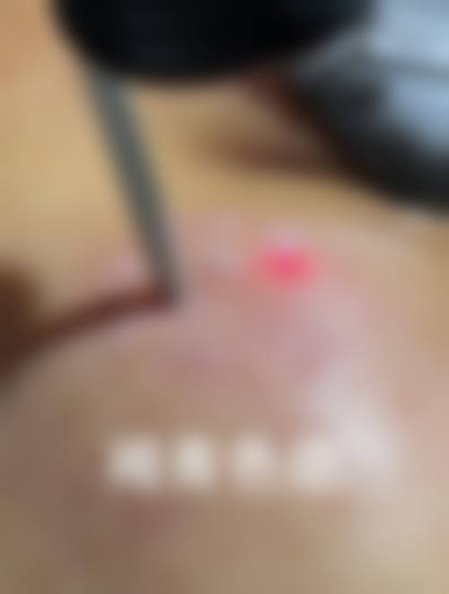 韩国宝妮达Bonita皮肤科口碑好不好