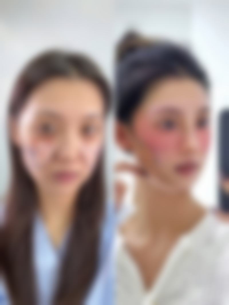 张浩医生做手术价格