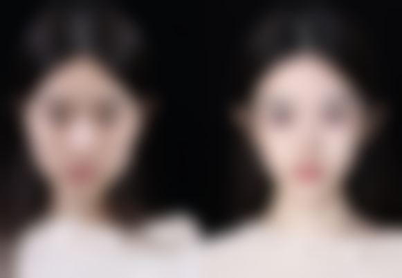 韩国迪美(THEM)整形美容医院口碑好不好?附真实患者口碑评价