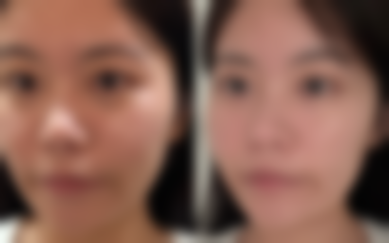 深圳美立达医疗美容门诊部怎么样，基本情况如何