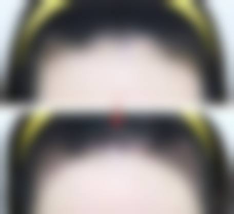 四川绵阳江油丽奥医疗美容诊所更擅长什么手术