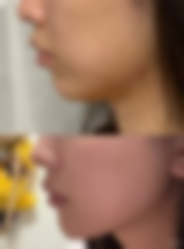 日喀则鑫鑫医疗美容诊所价格表