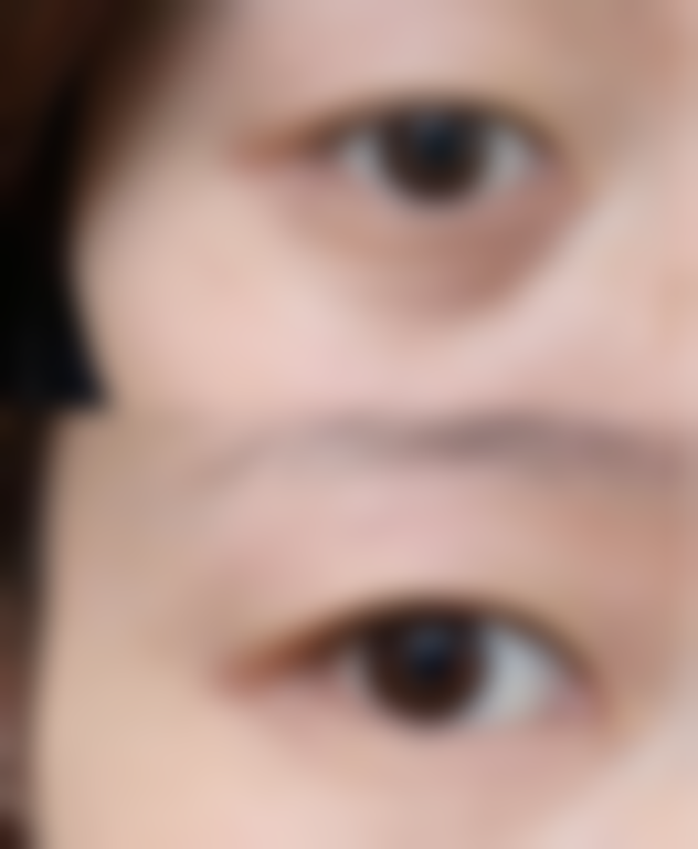 四川绵阳江油丽奥医疗美容诊所价格表